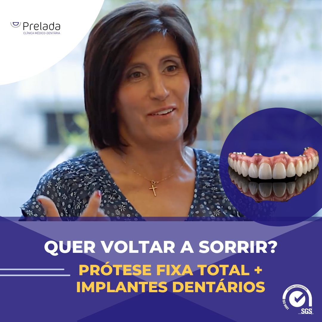 dentes fixos